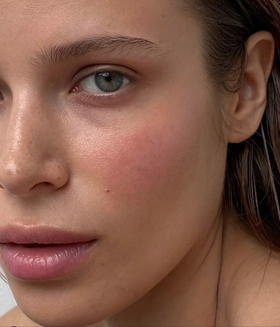 Tratamiento para la rosacea